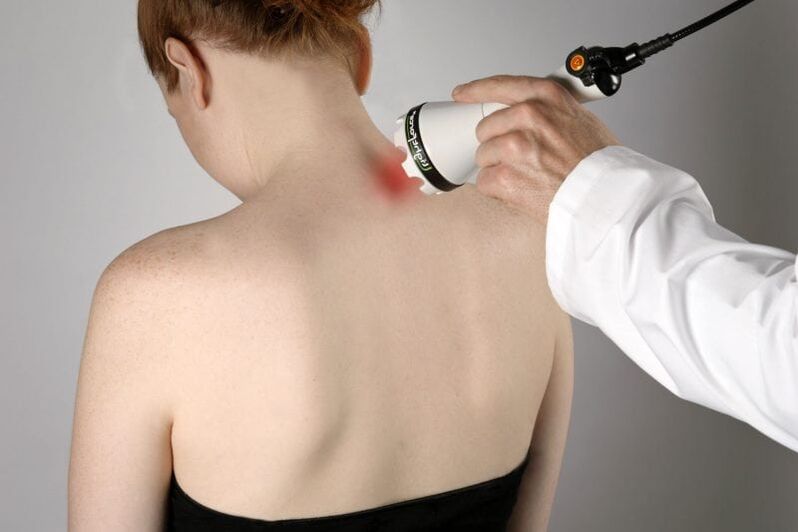 Lasersko zdravljenje cervikalne osteohondroze pri ženskah
